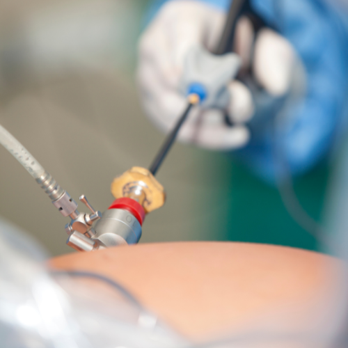 cirujano-especialista-en-laparoscopia-en-hospital-angeles-lomas.png