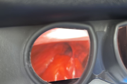 Endoscopia diagnostica en CDMX